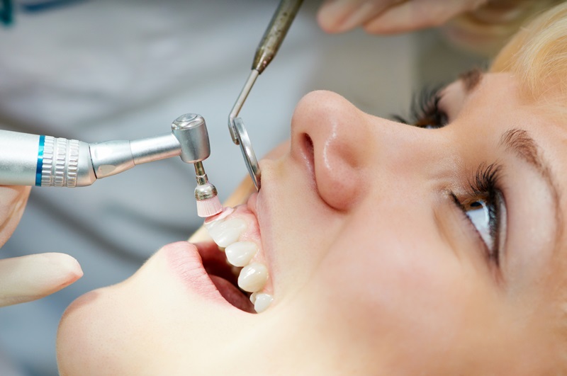 dental scaling murfreesboro tn