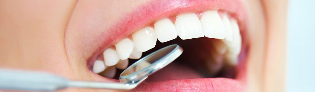 Types of Dental Fillings Dentist Murfreesboro TN