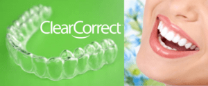 Clear Correct Clear Braces Murfreesboro TN